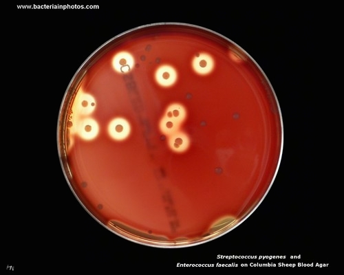 cocci on blood agar
